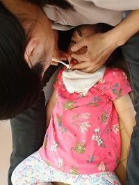 お母さんの膝の上に子どもの頭を乗せて、お母さんが白色の歯ブラシを持って女の子の唇を少し上にあげながら仕上げ磨きをしている様子の写真