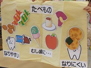 虫歯になりやすい食べ物（飴、チョコレート、アイスなど）と虫歯になりにくい食べ物（おせんべい、サツマイモ、りんごなど）のイラストが布に貼られている写真